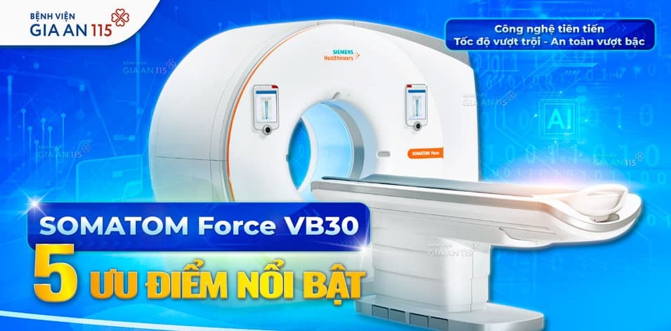 SOMATOM Force VB30 – 5 Ưu Điểm Nổi Bật của Siêu Máy CT tại Bệnh viện Gia An 115