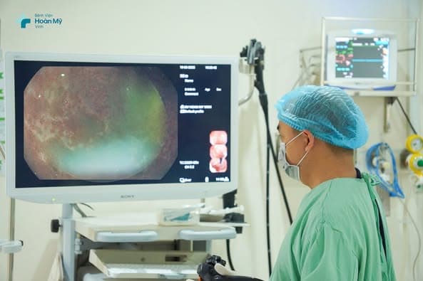 Viêm Teo Dạ Dày và Nguy Cơ Ung Thư: Vì Sao Cần Nội Soi Phát Hiện Sớm?