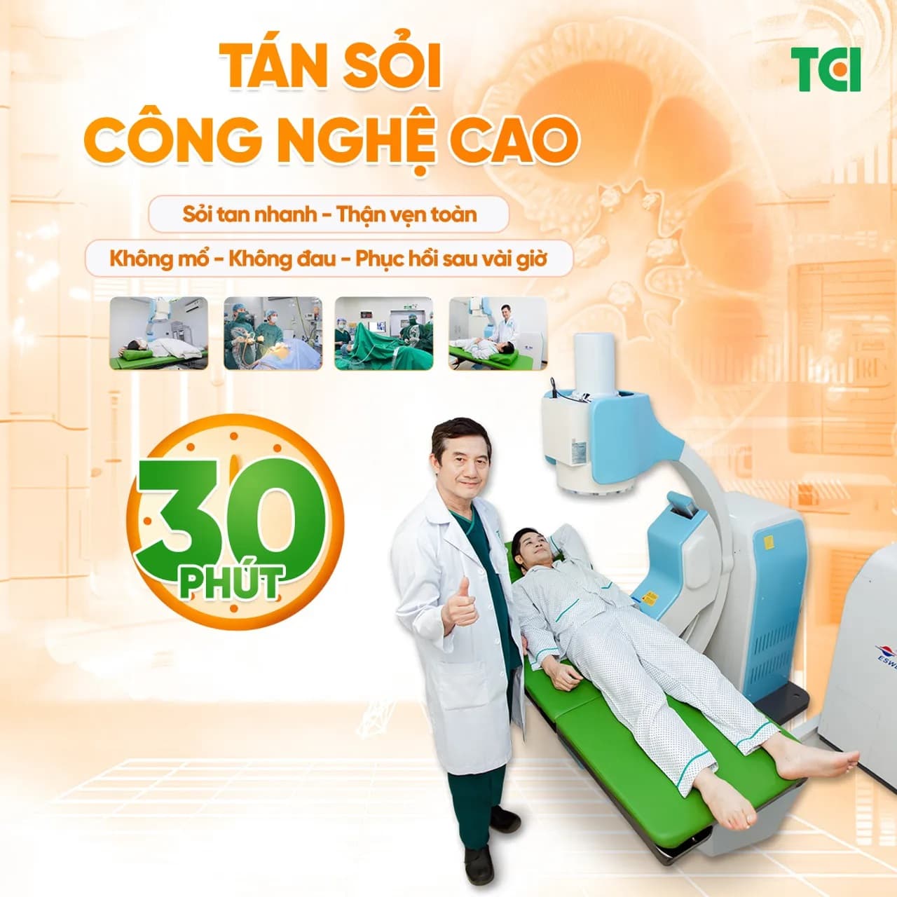 Tán sỏi thận – tiết niệu công nghệ cao tại Thu Cúc TCI: Không mổ mở, sạch sỏi nhanh, bảo tồn chức năng thận