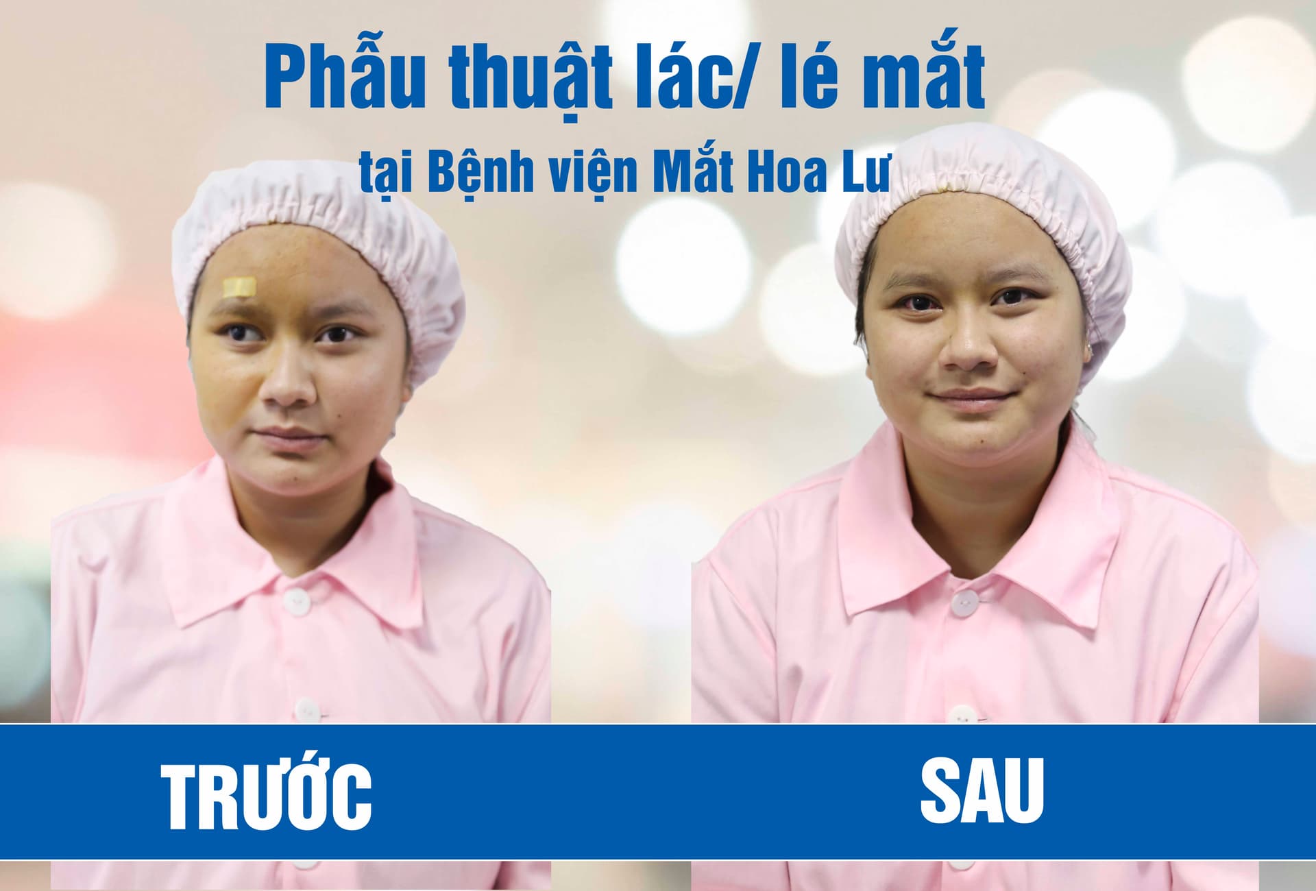 "Con này lác..." - Những lời trêu chọc khiến Tố Uyên tự ti suốt 20 năm