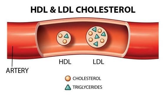 Chỉ số mỡ máu Triglyceride và biến chứng nguy hiểm cần lưu ý