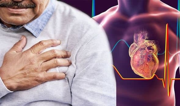 Viêm màng ngoài tim cấp - Chẩn đoán và điều trị