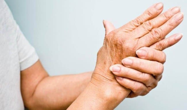 Sốt thấp khớp là bệnh gì? Các Xét nghiệm để chẩn đoán, điều trị và Phòng ngừa