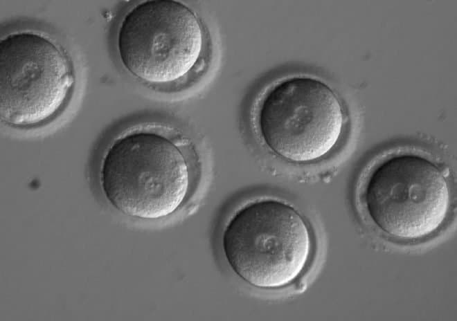 Chất lượng phôi có ý nghĩa thế nào khi làm thụ tinh ống nghiêm (IVF)?