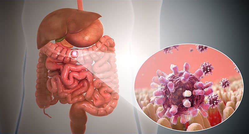 Viêm dạ dày ruột ở người lớn