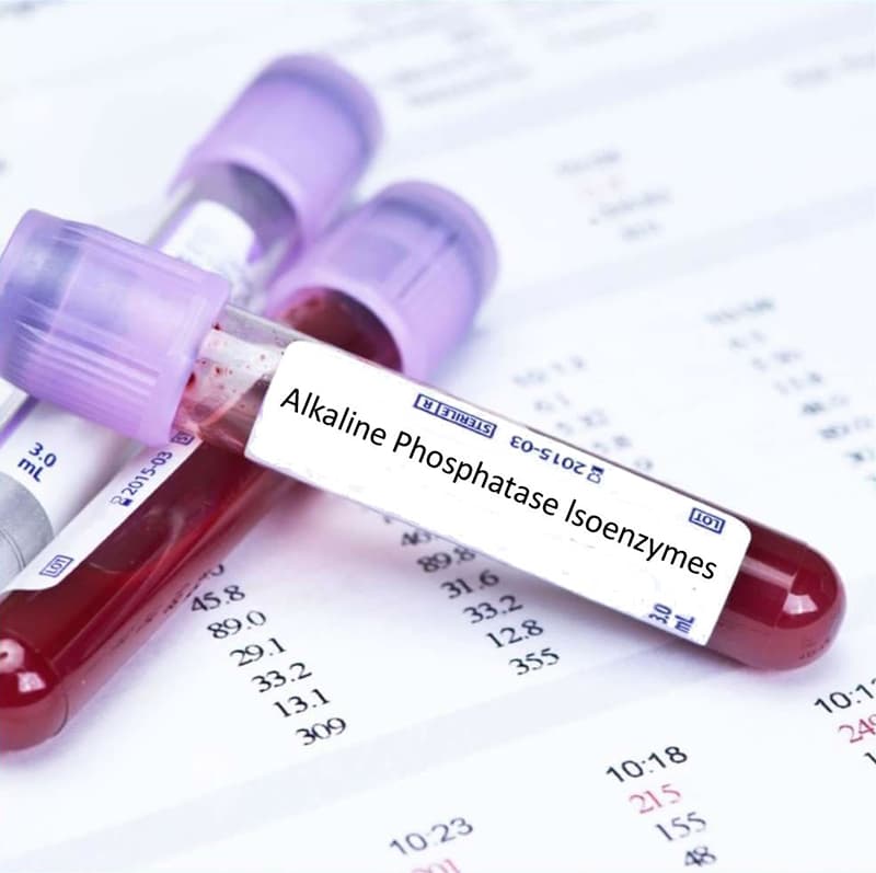 Ý nghĩa của xét nghiệm phosphatase kiềm (ALP) trong chẩn đoán bệnh gan xương