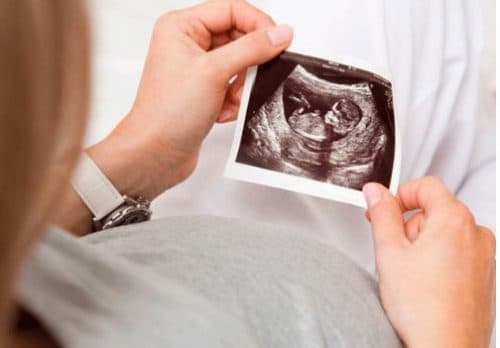 Suy thai do dây rốn thắt nút