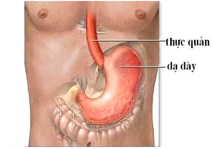Sự khác nhau giữa trào ngược dạ dày thực quản và Barrett thực quản