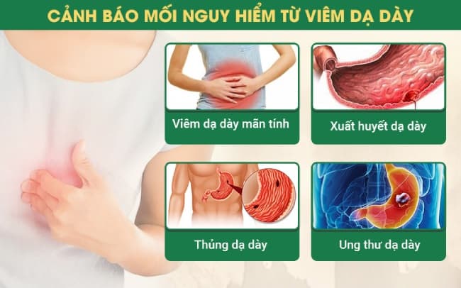 Điều trị viêm loét dạ dày hiệu quả