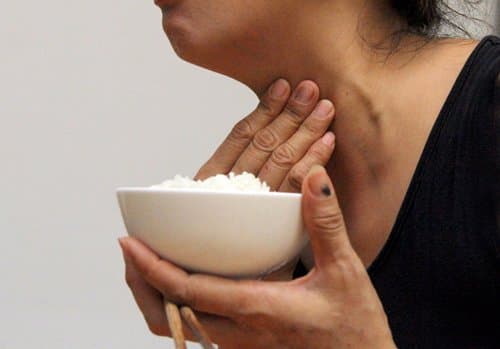 Điều trị u tuyến giáp lành tính bằng sóng cao tần không cần mổ