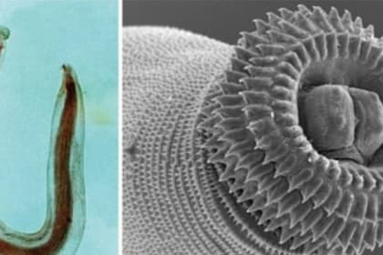 Giun đầu gai do Gnathostoma spinigerum: Triệu chứng và cách phòng tránh
