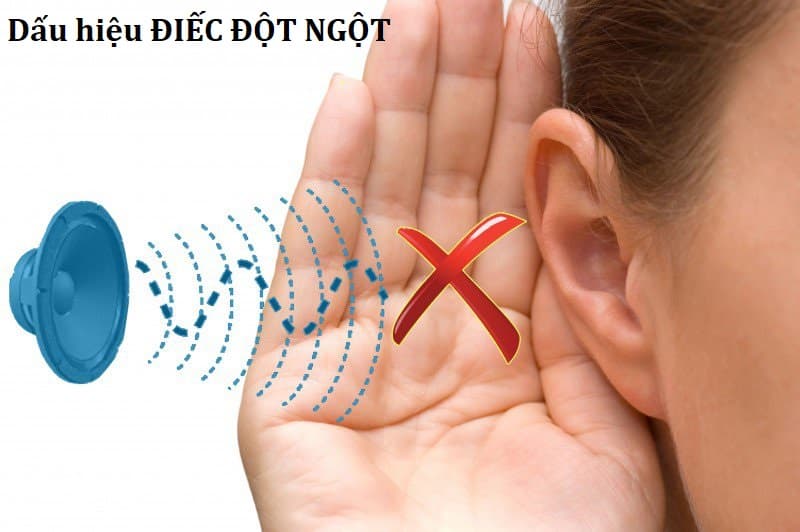 Điếc đột ngột - Nguyên nhân - triệu chứng và cách điều trị