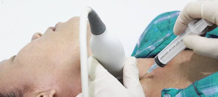 Xét nghiệm tế bào học trong chẩn đoán các bệnh lý tuyến giáp