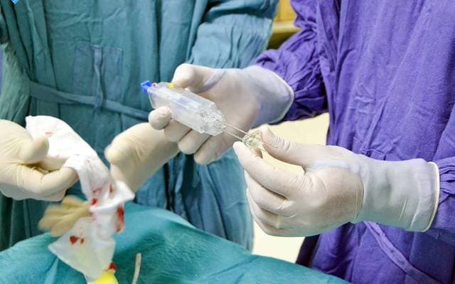 Mở thông dạ dày bằng phẫu thuật nội soi và các bệnh lý liên quan