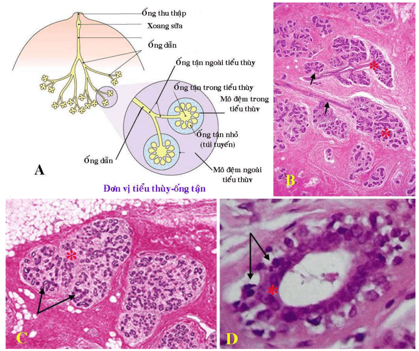 Kết quả giải phẫu bệnh ung thư vú có những điểm gì quan trọng?