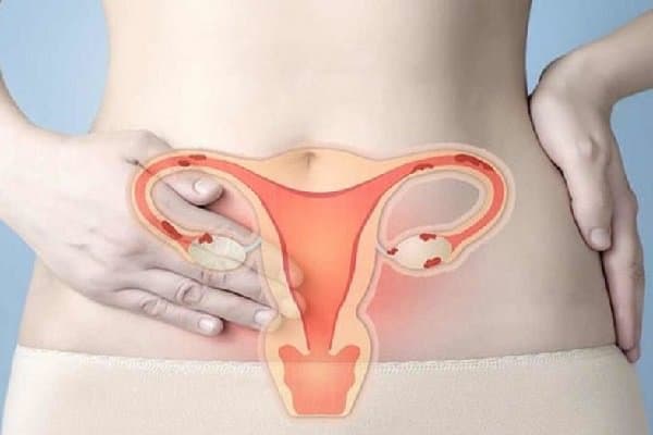 Khoét chóp cổ tử cung sẽ được chỉ định và thực hiện ra sao?