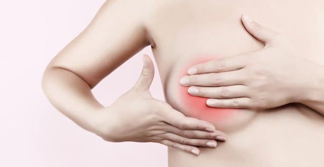 Xơ nang tuyến vú: Nguyên nhân, dấu hiệu và cách điều trị