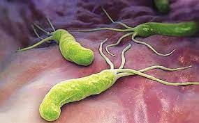 Nhiễm vi khuẩn Helicobacter pylori: Chẩn đoán và điều trị