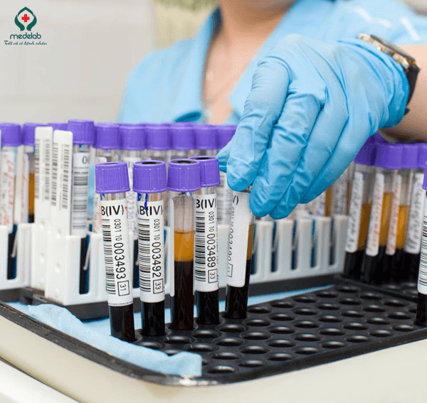 Medelab lấy mẫu xét nghiệm máu, nước tiểu Tại Nhà tiện lợi