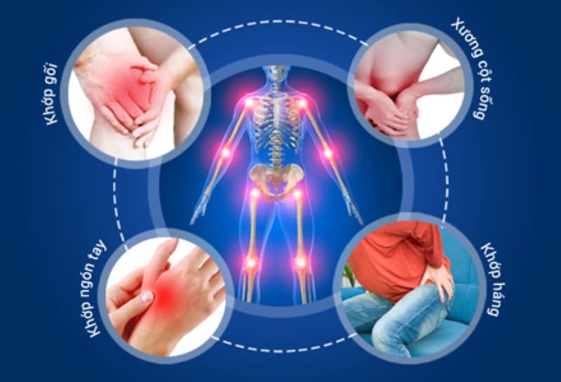 Để khám bệnh về cơ xương khớp, chi phí cần bao nhiêu?