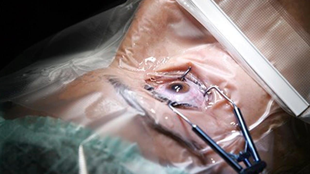 Đánh giá 6 cơ sở phẫu thuật cận Lasik hàng đầu tại Hà Nội