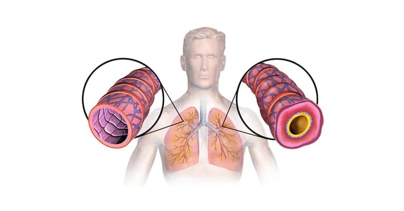 6 Địa Chỉ Khám Chữa Viêm Phế Quản Tốt Tại TP.HCM