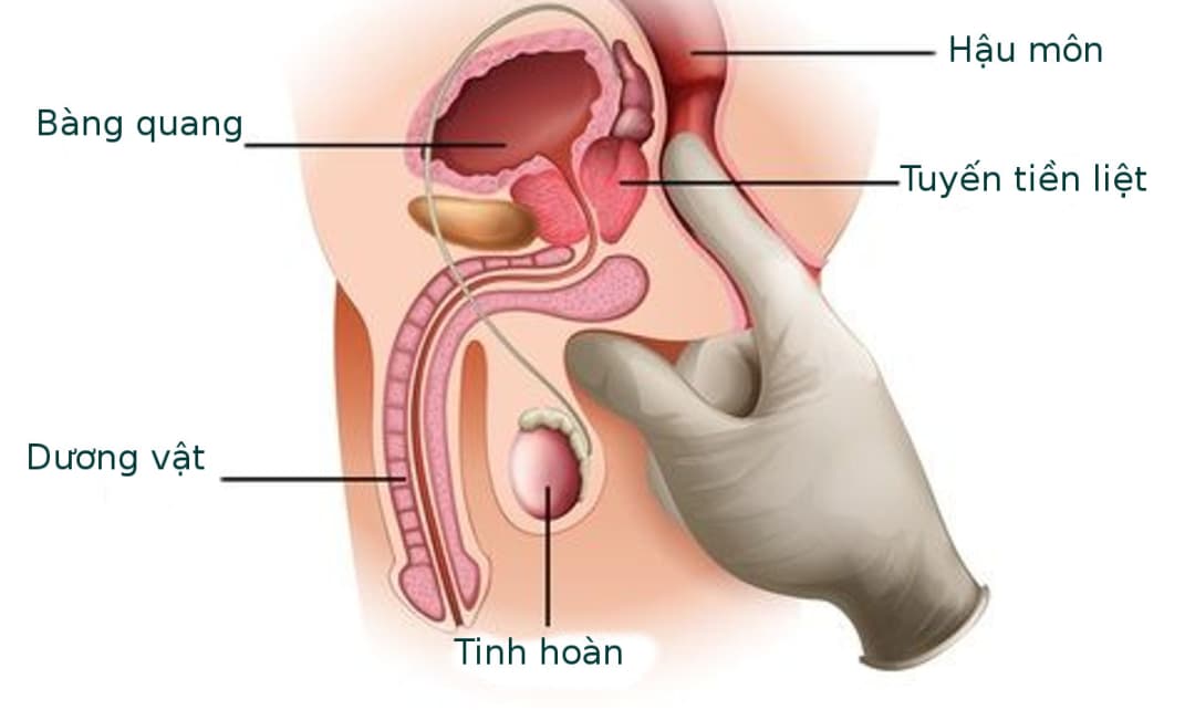 5 cơ sở khám và điều trị bệnh tuyến tiền liệt đáng tin cậy tại Hà Nội