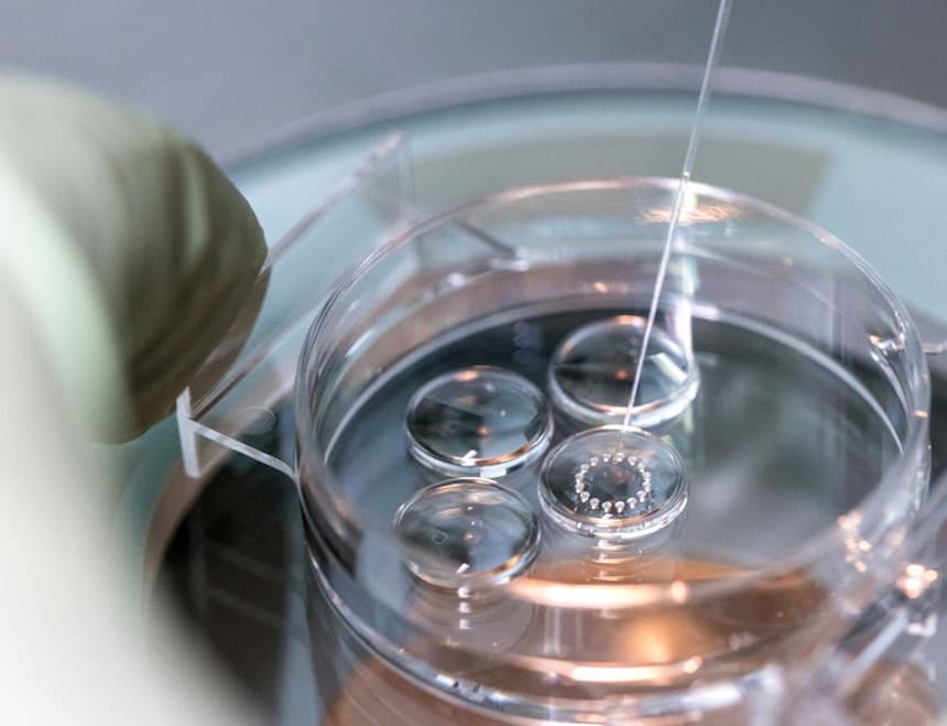 Chi phí thực hiện IVF là bao nhiêu? Cập nhật bảng giá IVF tại 7 cơ sở uy tín ở TP.HCM