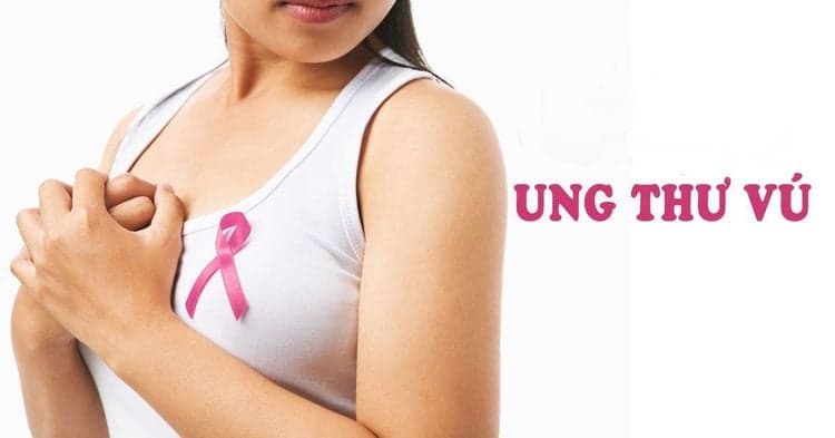 Ung thư vú giai đoạn 0: Những điều cần biết để phát hiện sớm và Điều trị hiệu quả