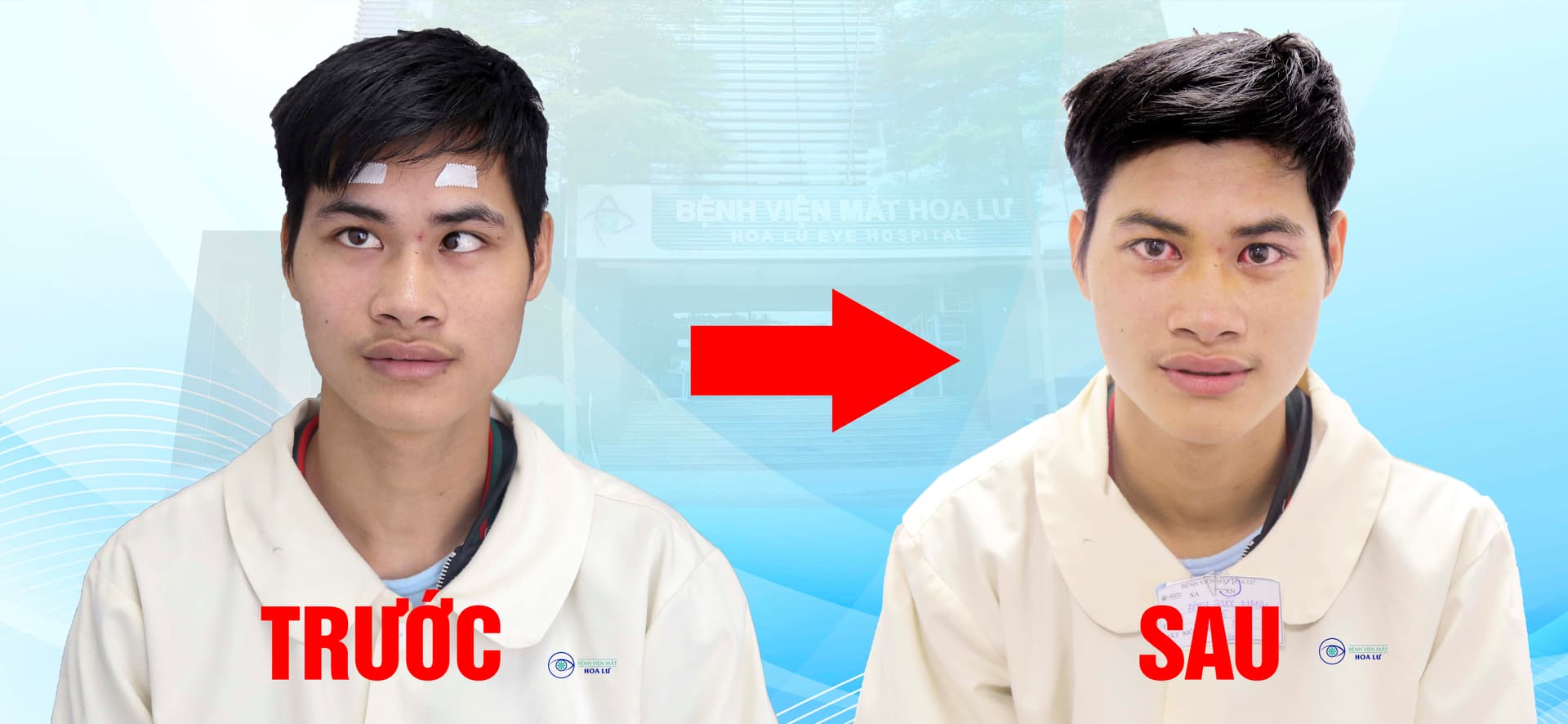 TỪ MẶC CẢM “MẮT LÁC” ĐẾN GIẤC MƠ KHOÁC ÁO LÍNH: HÀNH TRÌNH CỦA TÂN BINH ĐINH QUỐC MẠNH