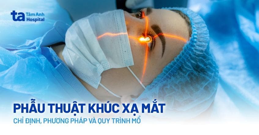 Thời gian mắt ổn định sau phẫu thuật LASIK: Bao lâu nhìn rõ hoàn toàn?