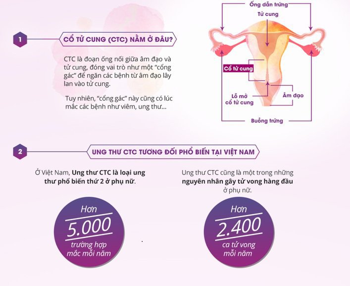 Ung thư cổ tử cung giai đoạn đầu có dấu hiện như thế nào? - ảnh 1