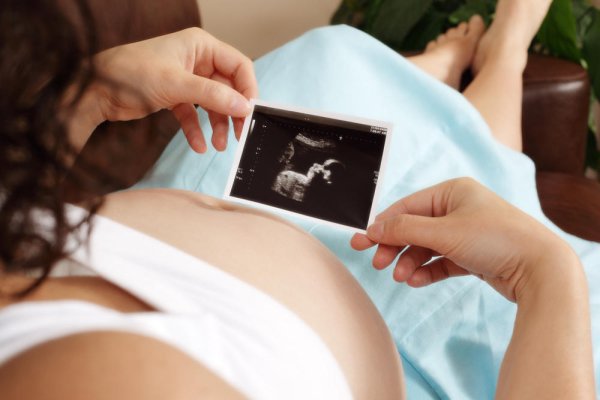 3 mốc siêu âm thai định kỳ quan trọng mẹ bầu cần ghi nhớ - ảnh 2
