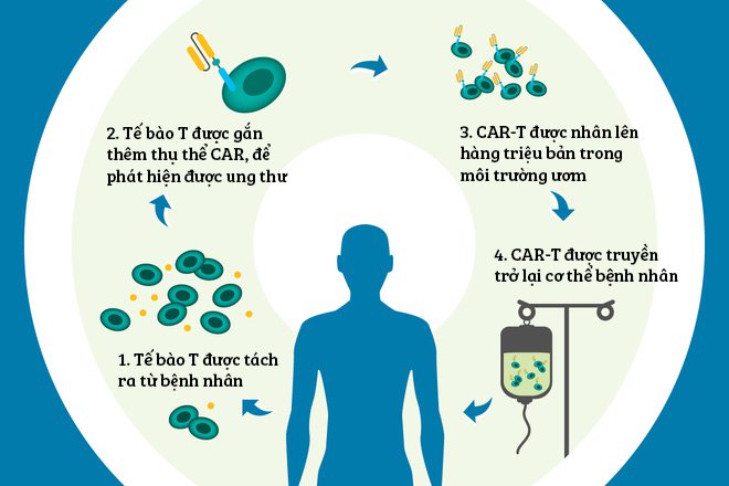 Liệu pháp tế bào CAR-T trong điều trị ung thư