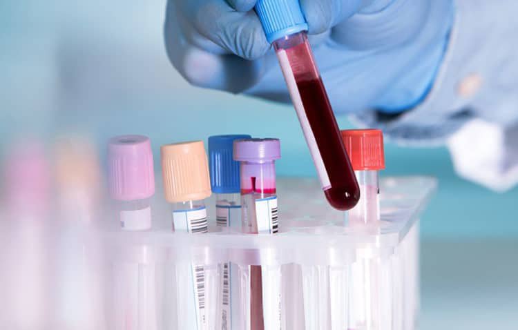 Vì sao lên Xét nghiệm máu tổng quát để phát hiện bệnh?
