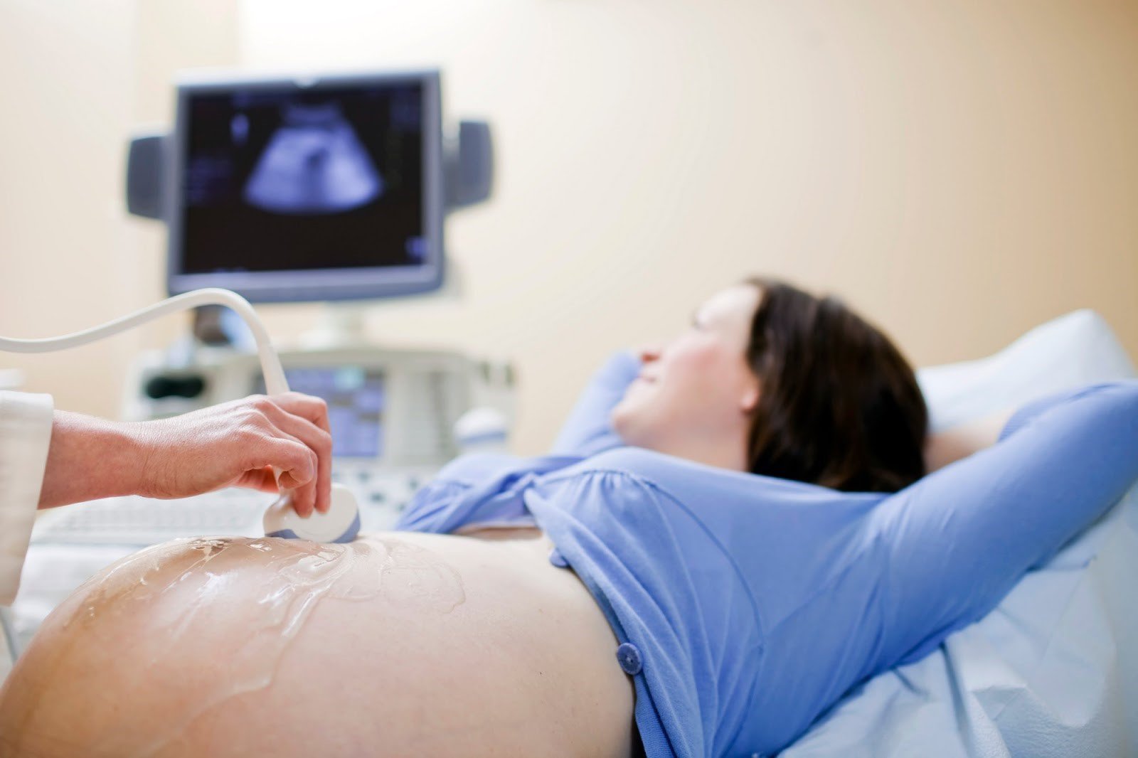 Tại sao mẹ bầu cần phải siêu âm tầm soát dị tật thai nhi? - ảnh 1