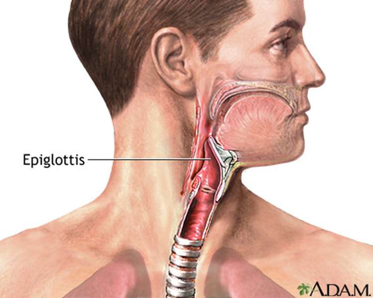 Ảnh 2 của Epiglottitis