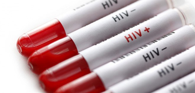 3 con đường lây truyền của virus HIV - ảnh 2