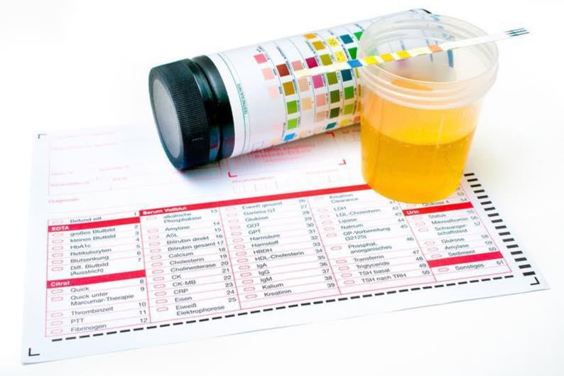 Ý nghĩa của xét nghiệm máu và nước tiểu trong gói khám sức khỏe tổng quát - ảnh 3
