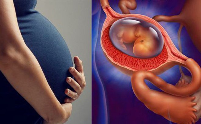 Thai ngoài tử cung có sinh được không hay bắt buộc phải điều trị?