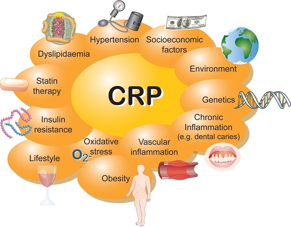 Xét nghiệm CRP chẩn đoán bệnh gì? và hướng dẫn đọc kết quả