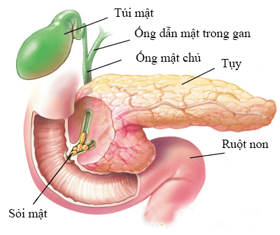 Cắt bỏ túi mật ảnh hưởng gì đến sức khoẻ? - ảnh 1