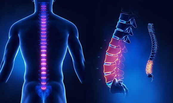 Vai trò của chụp cộng hưởng từ (MRI) trong chẩn đoán các bệnh cột sống, thắt lưng