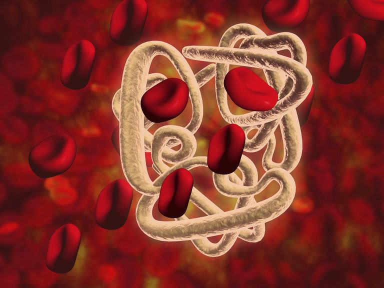 Làm thế nào để phát hiện bệnh thalassemia hay tan máu bẩm sinh ?