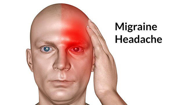 Phân biệt đau nửa đầu và bệnh thiên đầu thống (tăng nhãn áp - glocom) - ảnh 1