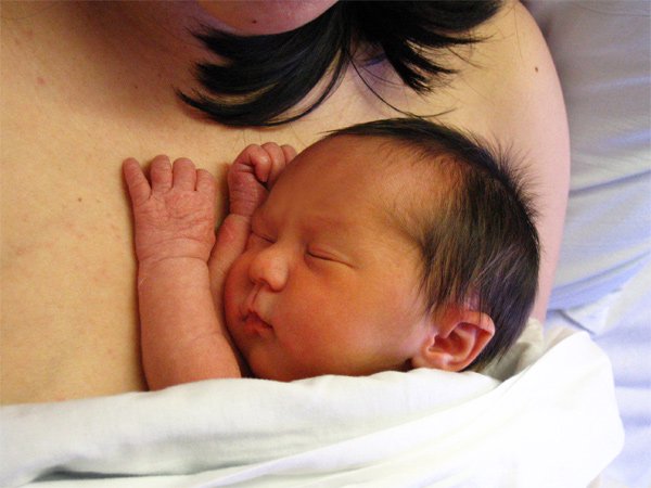 Những dấu hiệu bất thường ở rốn trẻ sơ sinh các mẹ cần biết - ảnh 2
