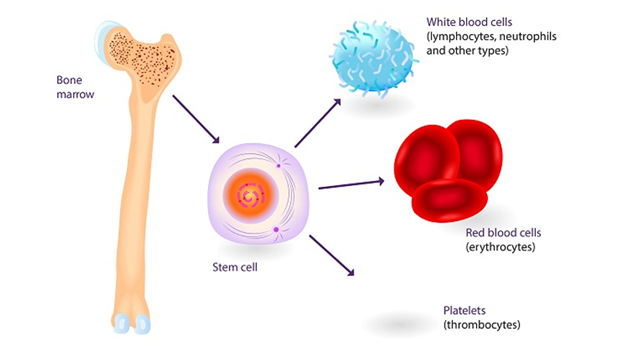 Ghép tế bào gốc giúp Điều trị ung thư ? - ảnh 1