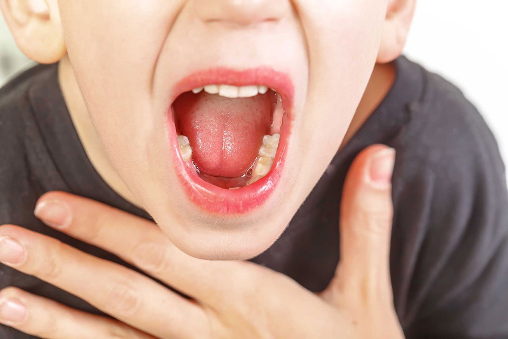 Các bệnh tai mũi họng thường gặp ở trẻ em và người lớn mọi người lên biết - ảnh 1