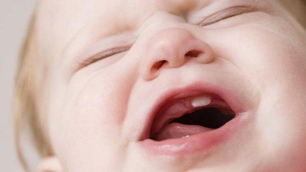 Chậm mọc răng: Nguyên nhân, phòng tránh và Quá trình mọc răng của trẻ