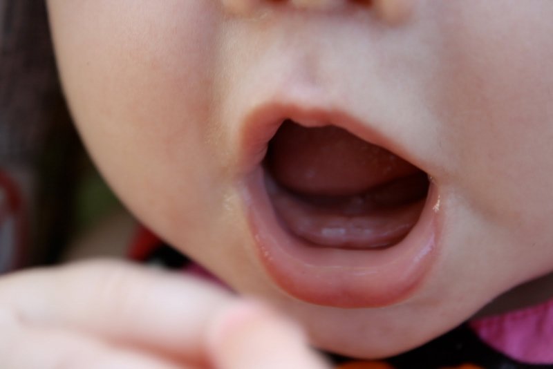 Chậm mọc răng: Nguyên nhân, phòng tránh và Quá trình mọc răng của trẻ - ảnh 3